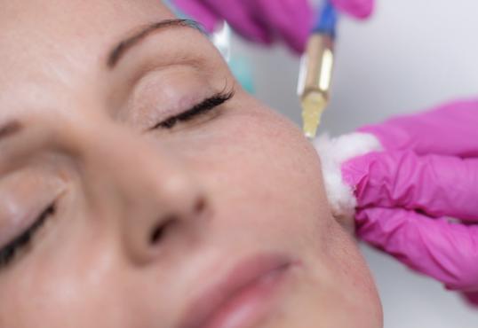 lady having her cheek enhancement treatment done