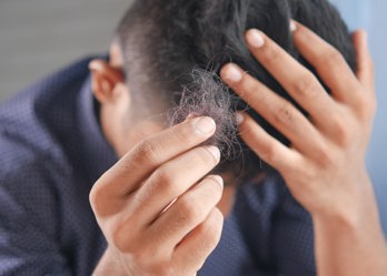A man holding his head in his hand while holding the hair he is loosing in the other hand